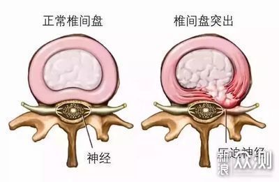 @上班族丨你，坐「错」了吗！（内附多视频） _新浪众测