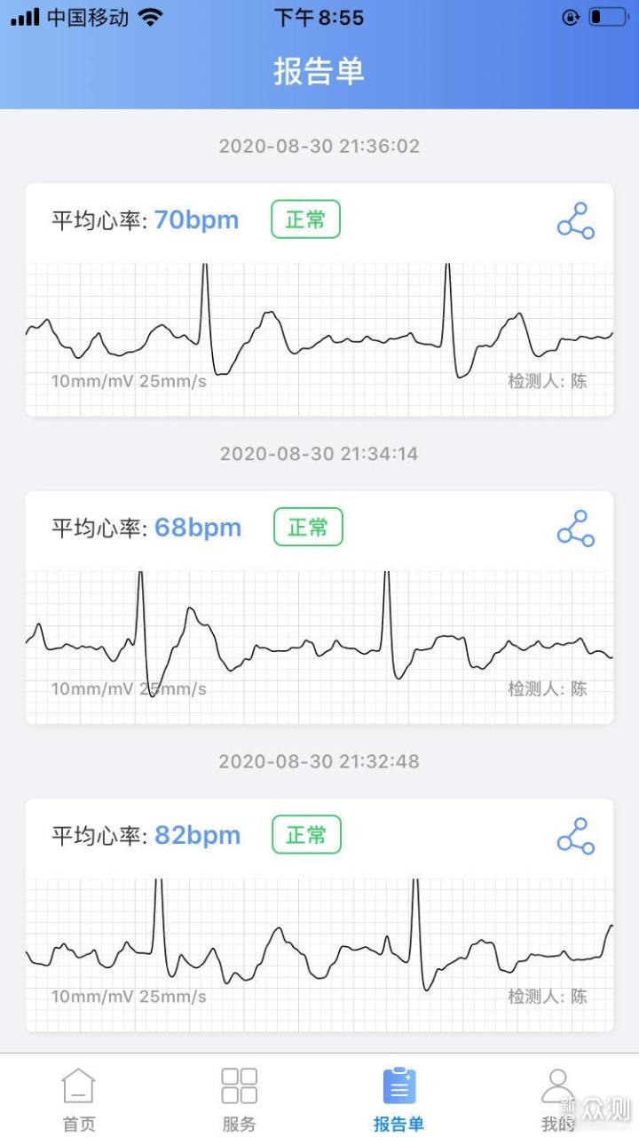 我真的不是太阳镜，说说卡帕奇手持心电监护仪_新浪众测