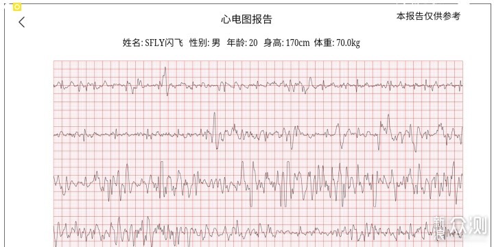 米家运动心电T恤体验：运动穿这个就够了！_新浪众测