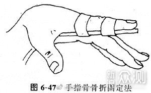 现场外伤急救技术_新浪众测