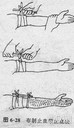 现场外伤急救技术_新浪众测