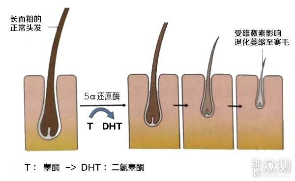 打赢防脱生发的战争，我们有必要了解一下这些_新浪众测