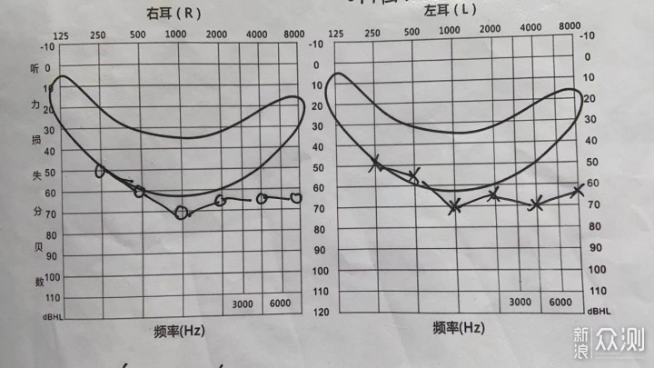 让听障朋友重回有声世界，左点耳内式助听器_新浪众测