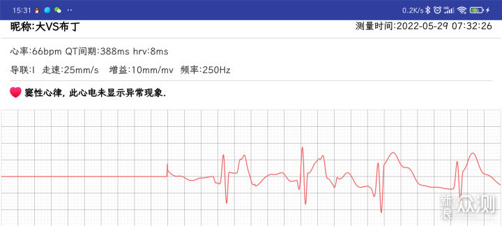 血壓監測ai心電圖疾病篩查didoy1評測