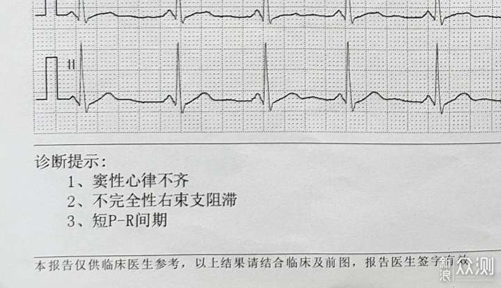 健康管理神器！Dido E10血压心电智能手表！_新浪众测