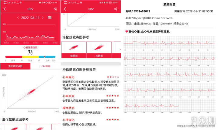 心血管疾病最要命，要精准监控，用didoY1手环_新浪众测