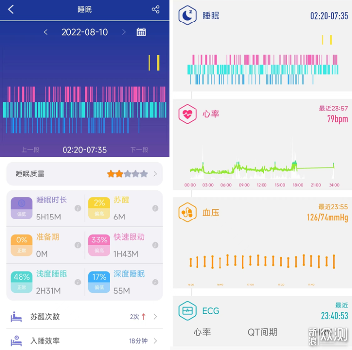 dido G28S Pro心电血压智能手表，健康又实用_新浪众测