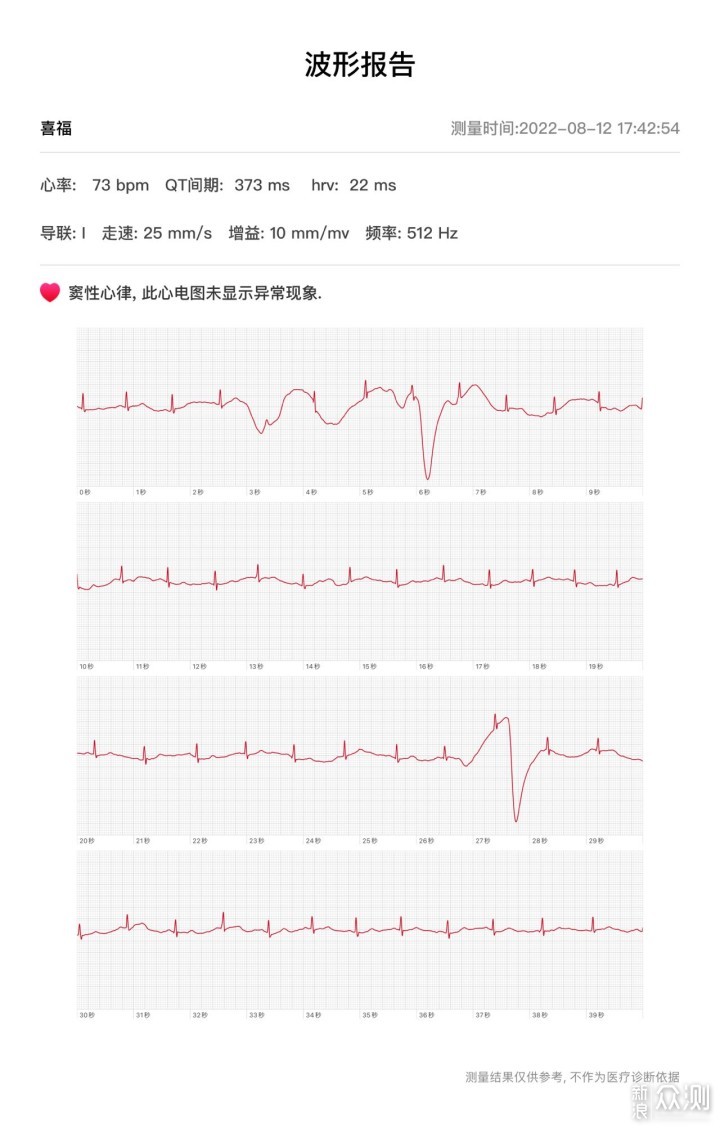 Dido G28S 心电血压智能手表守护随时掌控 _新浪众测