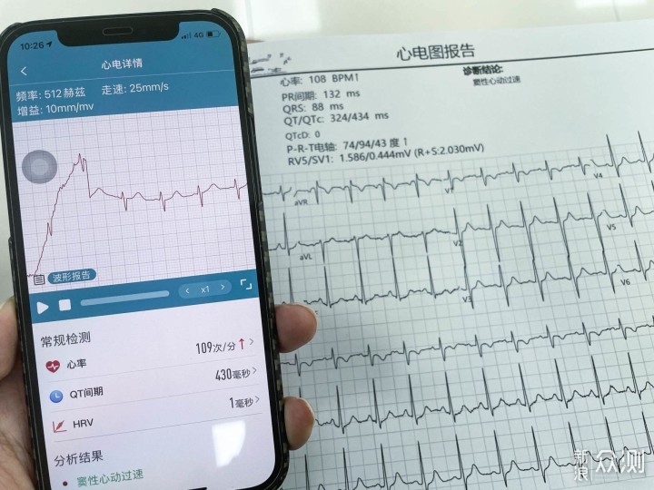 专业医疗级守护—dido G28S心电血压智能手表_新浪众测