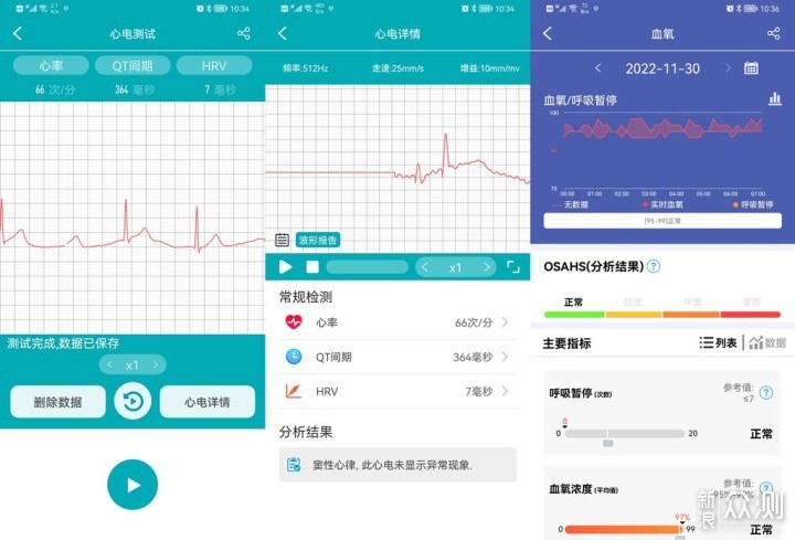 24h监测，dido E55S无创血糖监测智能手表体验_新浪众测