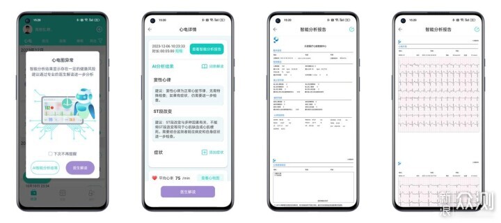 乐普Lepod Pro 8导联长程动态心电记录仪_新浪众测