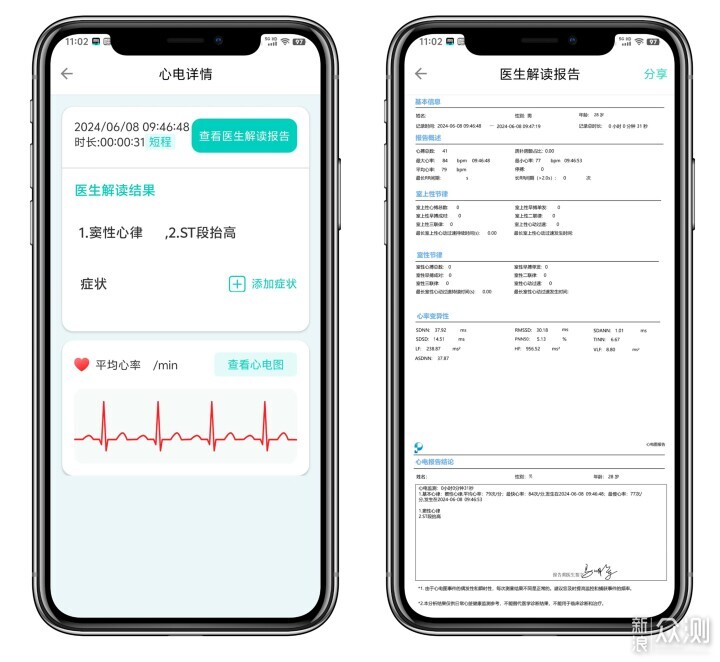 心电监测如此简单？乐普ER2-S，守护心脏健康_新浪众测