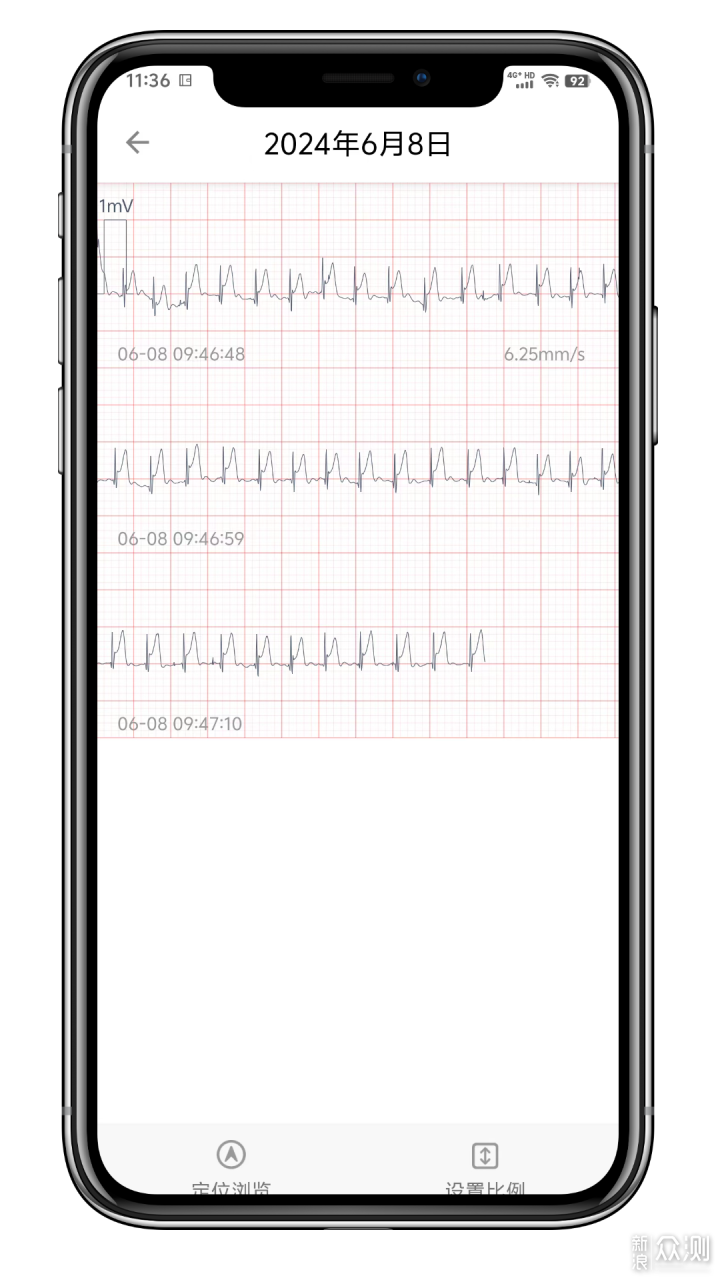 心电监测如此简单？乐普ER2-S，守护心脏健康_新浪众测