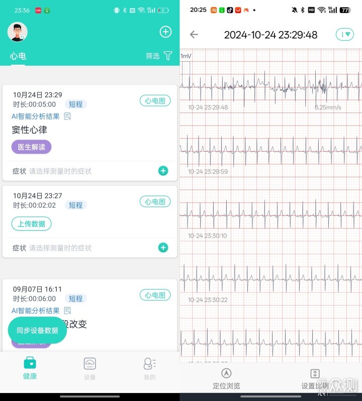 精准记录，乐普Lepod Pro多导联心电记录仪_新浪众测