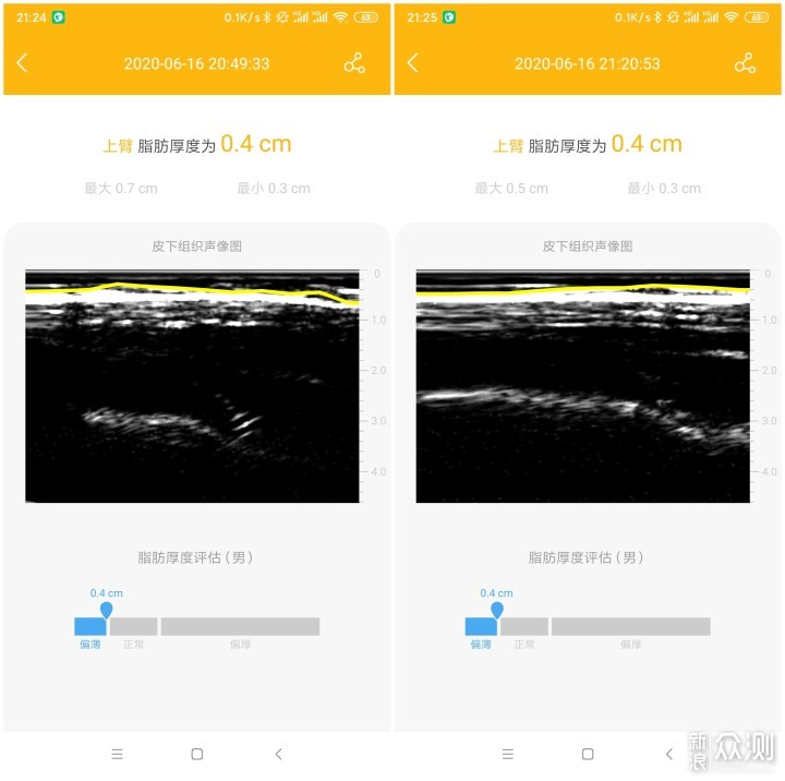 脂肪厚度仪真实用还是智商税？_新浪众测