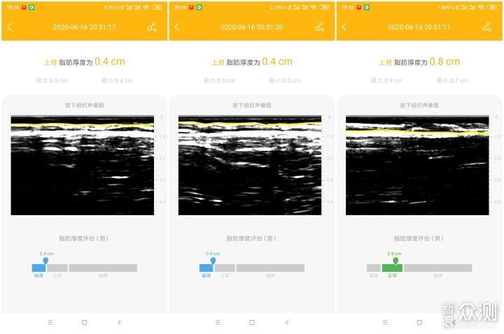 脂肪厚度检测仪是真实用还是交智商税？_新浪众测