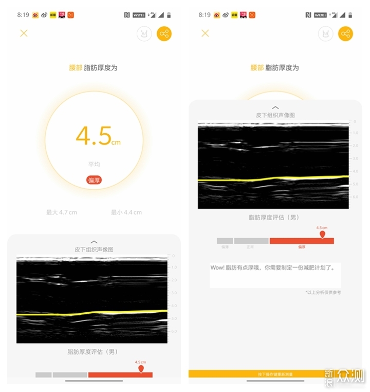 让美丽轻松一点，脂肪厚度仪上手体验_新浪众测