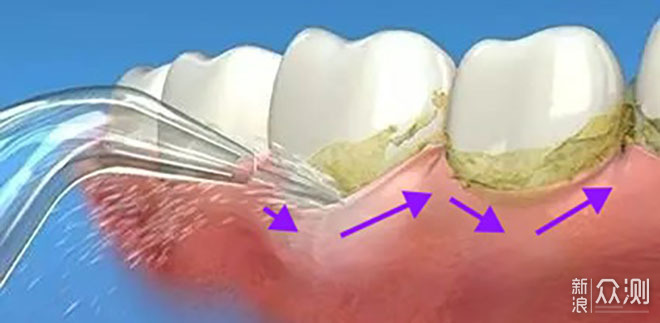 看的见的牙齿清洗，素诺智能可视冲牙器C3 Pro_新浪众测